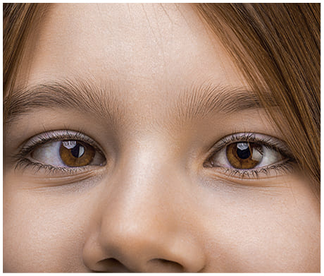 What Is Binocular Vision Dysfunction? Your Questions Answered